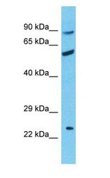 RHCE / RH Antibody - RHCE / RH antibody Western Blot of Uterus Tumor. Antibody dilution: 1 ug/ml.  This image was taken for the unconjugated form of this product. Other forms have not been tested.