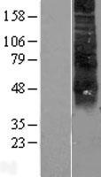 RHCE / RH Protein - Western validation with an anti-DDK antibody * L: Control HEK293 lysate R: Over-expression lysate