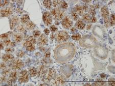 RHCG Antibody - Immunoperoxidase of monoclonal antibody to RHCG on formalin-fixed paraffin-embedded human salivary gland (antibody concentration 3 ug/ml).