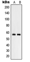 RHCG Antibody - Western blot analysis of RHCG expression in NCIH460 (A); human testis (B) whole cell lysates.