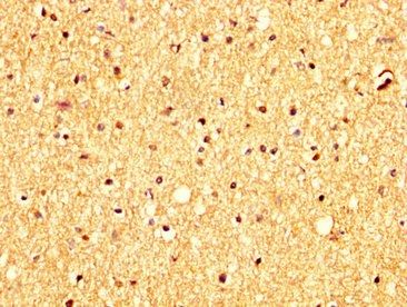 RHCG Antibody - Immunohistochemistry image at a dilution of 1:300 and staining in paraffin-embedded human brain tissue performed on a Leica BondTM system. After dewaxing and hydration, antigen retrieval was mediated by high pressure in a citrate buffer (pH 6.0) . Section was blocked with 10% normal goat serum 30min at RT. Then primary antibody (1% BSA) was incubated at 4 °C overnight. The primary is detected by a biotinylated secondary antibody and visualized using an HRP conjugated SP system.