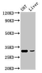 RHCG Antibody - Positive Western Blot detected in U87 whole cell lysate, Rat liver tissue. All lanes: ITM2B antibody at 4.9 µg/ml Secondary Goat polyclonal to rabbit IgG at 1/50000 dilution. Predicted band size: 31, 19 KDa. Observed band size: 31 KDa