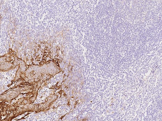 RHCG Antibody - Immunochemical staining of human RHCG in human tonsil with rabbit polyclonal antibody at 1:200 dilution, formalin-fixed paraffin embedded sections.