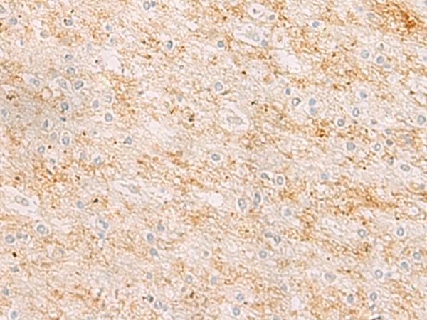 RHCG Antibody - Immunohistochemistry of paraffin-embedded Human brain tissue  using RHCG Polyclonal Antibody at dilution of 1:25(×200)