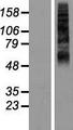 RHCG Protein - Western validation with an anti-DDK antibody * L: Control HEK293 lysate R: Over-expression lysate