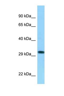 RHD Antibody - RHD antibody Western blot of 8226 Cell lysate. Antibody concentration 1 ug/ml.  This image was taken for the unconjugated form of this product. Other forms have not been tested.