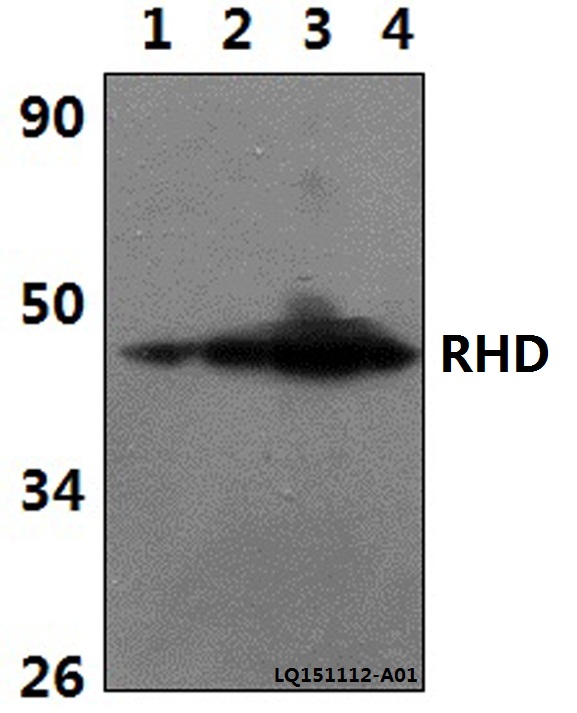 RHD Antibody - Western blot of RHD polyclonal antibody at 1:500 dilution. Lane 1: The Brain tissue lysate of Rat(30 ug). Lane 2: The Brain tissue lysate of Mouse(30 ug). Lane 3: HEK293T whole cell lysate (40 ug). Lane 4: H9C2 whole cell lysate (40 ug).