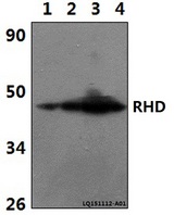 RHD Antibody - Western blot of RHD polyclonal antibody at 1:500 dilution. Lane 1: The Brain tissue lysate of Rat(30 ug). Lane 2: The Brain tissue lysate of Mouse(30 ug). Lane 3: HEK293T whole cell lysate (40 ug). Lane 4: H9C2 whole cell lysate (40 ug).