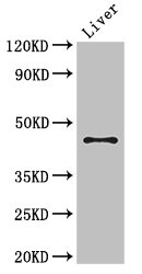 RHD Antibody - Western Blot Positive WB detected in:Mouse liver tissue All Lanes: RHD antibody at 3ug/ml Secondary Goat polyclonal to rabbit IgG at 1/50000 dilution Predicted band size: 46,35,54,44,42 kDa Observed band size: 46 kDa