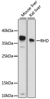 RHD Antibody - Western blot analysis of extracts of various cell lines, using RHD antibody at 1:1000 dilution. The secondary antibody used was an HRP Goat Anti-Rabbit IgG (H+L) at 1:10000 dilution. Lysates were loaded 25ug per lane and 3% nonfat dry milk in TBST was used for blocking. An ECL Kit was used for detection and the exposure time was 15s.