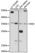 RHD Antibody - Western blot analysis of extracts of various cell lines, using RHD antibody at 1:1000 dilution. The secondary antibody used was an HRP Goat Anti-Rabbit IgG (H+L) at 1:10000 dilution. Lysates were loaded 25ug per lane and 3% nonfat dry milk in TBST was used for blocking. An ECL Kit was used for detection and the exposure time was 15s.