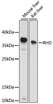 RHD Antibody - Western blot analysis of extracts of various cell lines using RHD Polyclonal Antibody at dilution of 1:1000.