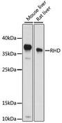 RHD Antibody - Western blot analysis of extracts of various cell lines using RHD Polyclonal Antibody at dilution of 1:1000.