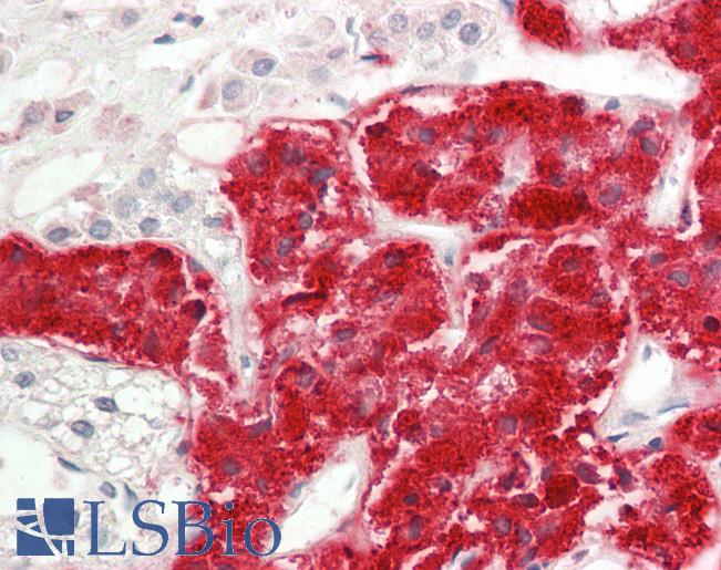 RHEB Antibody - Human Adrenal: Formalin-Fixed, Paraffin-Embedded (FFPE).  This image was taken for the unconjugated form of this product. Other forms have not been tested.