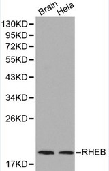 RHEB Antibody - Western blot of RHEB pAb in extracts from mouse brain tissue and Hela cells.