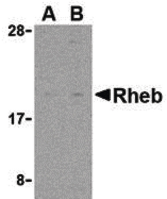 RHEB Antibody - Western blot of Rheb in rat heart cell lysate with Rheb antibody at (A) 2 and (B) 4 ug/ml.