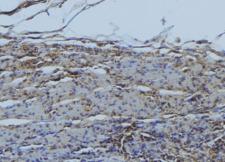 RHEB Antibody - 1:100 staining mouse muscle tissue by IHC-P. The sample was formaldehyde fixed and a heat mediated antigen retrieval step in citrate buffer was performed. The sample was then blocked and incubated with the antibody for 1.5 hours at 22°C. An HRP conjugated goat anti-rabbit antibody was used as the secondary.