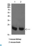 RHEB Antibody - Western Blot (WB) analysis of Mouse Kidney Mouse Brain cells using RHEB Polyclonal Antibody diluted at 1:2000.