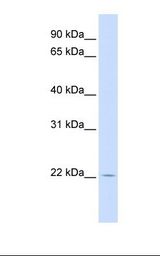 RHEBL1 Antibody - Fetal muscle lysate. Antibody concentration: 1.0 ug/ml. Gel concentration: 12%.  This image was taken for the unconjugated form of this product. Other forms have not been tested.