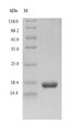 gB Protein - (Tris-Glycine gel) Discontinuous SDS-PAGE (reduced) with 5% enrichment gel and 15% separation gel.