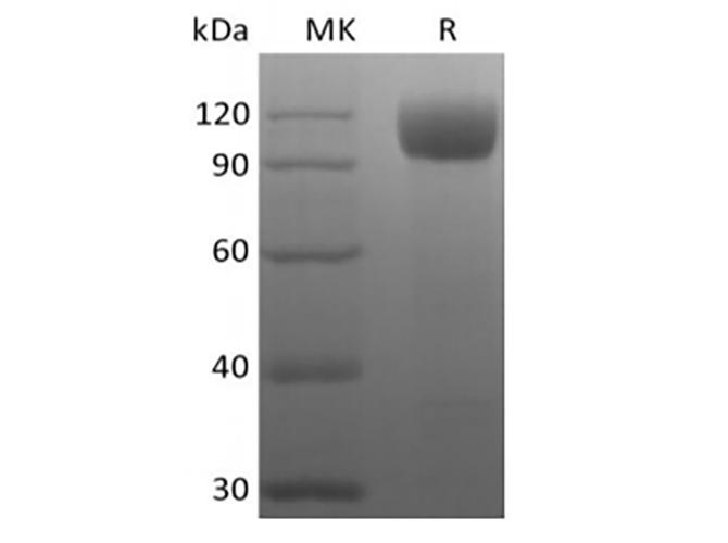ACE2 / ACE-2 Protein - Recombinant Rhesus Macaque Angiotensin-Converting Enzyme 2/ACE-2 (C-10His)