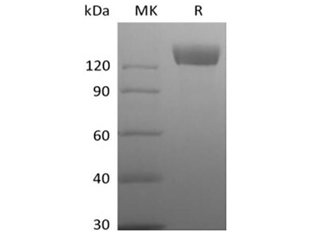 ACE2 / ACE-2 Protein - Recombinant Rhesus Macaque Angiotensin-Converting Enzyme 2/ACE-2 (C-Fc)