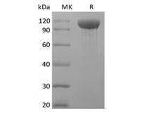 ANGPT2 / Angiopoietin-2 Protein - Recombinant Rhesus Macaque Angiopoietin-2/ANG2 (C-Fc)