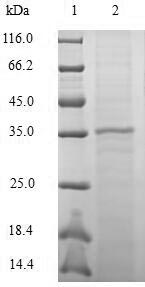 CCL20 / MIP-3-Alpha Protein - (Tris-Glycine gel) Discontinuous SDS-PAGE (reduced) with 5% enrichment gel and 15% separation gel.