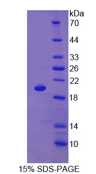 CD59 Protein - Recombinant Protectin By SDS-PAGE