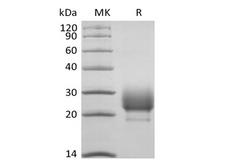 CD79B / CD79 Beta Protein - Recombinant Rhesus Macaque CD79B/B29 (C-6His)