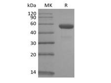 CD79B / CD79 Beta Protein - Recombinant Rhesus Macaque CD79B/B29 (C-Fc)