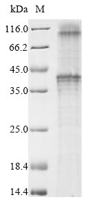 GnRH-II-R / GNRHR2 Protein - (Tris-Glycine gel) Discontinuous SDS-PAGE (reduced) with 5% enrichment gel and 15% separation gel.