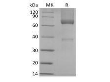 GPC3 / Glypican 3 Protein - Recombinant Rhesus Macaque Glypican-3/GPC3/OCI5 (C-6His)