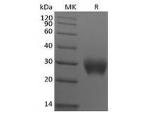 LAIR1 / CD305 Protein - Recombinant Rhesus Macaque Leukocyte-associated Immunoglobulin-like Receptor 1/LAIR1/CD305 (C-6His)