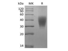 SLAMF7 / CRACC Protein - Recombinant Rhesus Macaque SLAM Family Member 7/SLAMF7/CD319/CRACC (C-6His)