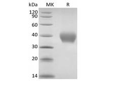 TNFRSF1B / TNFR2 Protein - Recombinant Rhesus Macaque TNF Receptor II/TNF RII/TNFRSF1B/CD120b (C-6His)