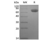 TNFRSF1B / TNFR2 Protein - Recombinant Rhesus Macaque TNF Receptor II/TNF RII/TNFRSF1B/CD120b (C-Fc)