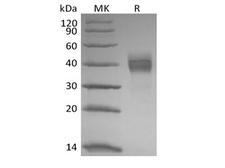 TROP2 / TACSTD2 Protein - Recombinant Rhesus Macaque Tumor-associated Calcium Signal Transducer 2/TROP-2 (C-6His)