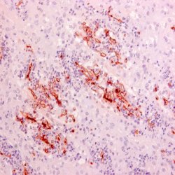 Rhizopus arrhizus WSSA Antibody - Renal tissue presenting zygomycosis stained with Mouse anti-Rhizopus Arrhizus
