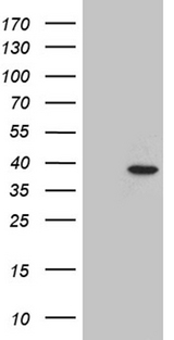 RHNO1 / C12orf32 Antibody - HEK293T cells were transfected with the pCMV6-ENTRY control. (Left lane) or pCMV6-ENTRY C12orf32. (Right lane) cDNA for 48 hrs and lysed. Equivalent amounts of cell lysates. (5 ug per lane) were separated by SDS-PAGE and immunoblotted with anti-C12orf32. (1:500)