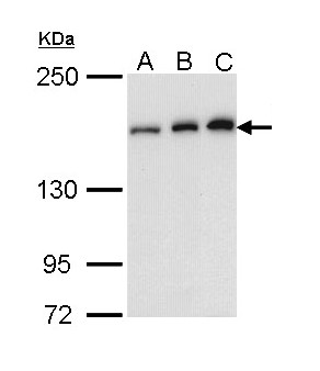 Rho Kinase / ROCK1 Antibody - Sample (30 ug of whole cell lysate). A: A431 , B: H1299, C: Molt-4 . 5% SDS PAGE. Rho Kinase / ROCK1 antibody diluted at 1:1000.