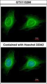 Rho Kinase / ROCK1 Antibody - Immunofluorescence of methanol-fixed HeLa using ROCK1 antibody at 1:200 dilution.