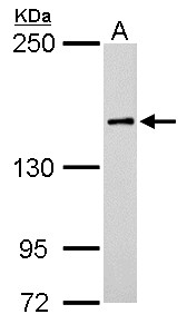 Rho Kinase / ROCK1 Antibody - ROCK1 antibody [N1N2], N-term detects ROCK1 protein by Western blot analysis. A. 50 ug rat brain lysate/extract. 5 % SDS-PAGE. ROCK1 antibody [N1N2], N-term dilution:1:500