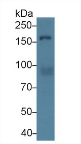 Rho Kinase / ROCK1 Antibody - Western Blot; Sample: Human Hela cell lysate; Primary Ab: 2µg/ml Rabbit Anti-Mouse Rock1 Antibody Second Ab: 0.2µg/mL HRP-Linked Caprine Anti-Rabbit IgG Polyclonal Antibody