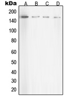 Rho Kinase / ROCK1 Antibody - Western blot analysis of ROCK1 expression in HeLa (A); NIH3T3 (B); C6 (C); COS7 (D) whole cell lysates.