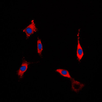 Rho Kinase / ROCK1 Antibody - Immunofluorescent analysis of ROCK1 staining in NIH3T3 cells. Formalin-fixed cells were permeabilized with 0.1% Triton X-100 in TBS for 5-10 minutes and blocked with 3% BSA-PBS for 30 minutes at room temperature. Cells were probed with the primary antibody in 3% BSA-PBS and incubated overnight at 4 C in a humidified chamber. Cells were washed with PBST and incubated with a DyLight 594-conjugated secondary antibody (red) in PBS at room temperature in the dark. DAPI was used to stain the cell nuclei (blue).