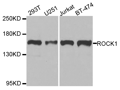 Rho Kinase / ROCK1 Antibody - Western blot analysis of extracts of various cell lines, using ROCK1 antibody at 1:1000 dilution. The secondary antibody used was an HRP Goat Anti-Rabbit IgG (H+L) at 1:10000 dilution. Lysates were loaded 25ug per lane and 3% nonfat dry milk in TBST was used for blocking. An ECL Kit was used for detection and the exposure time was 90s.