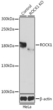 Rho Kinase / ROCK1 Antibody - Western blot analysis of extracts from normal (control) and ROCK1 knockout (KO) HeLa cells, using ROCK1 antibodyat 1:1000 dilution. The secondary antibody used was an HRP Goat Anti-Rabbit IgG (H+L) at 1:10000 dilution. Lysates were loaded 25ug per lane and 3% nonfat dry milk in TBST was used for blocking. An ECL Kit was used for detection and the exposure time was 3s.