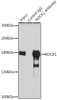 Rho Kinase / ROCK1 Antibody - Immunoprecipitation analysis of 200ug extracts of 293T cells, using 3 ug ROCK1 antibody. Western blot was performed from the immunoprecipitate using ROCK1 antibodyat a dilition of 1:1000.