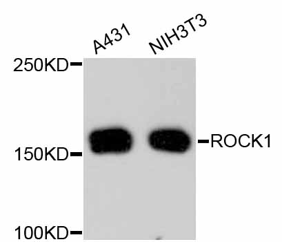 Rho Kinase / ROCK1 Antibody - Western blot analysis of extracts of various cell lines, using ROCK1 antibody. The secondary antibody used was an HRP Goat Anti-Rabbit IgG (H+L) at 1:10000 dilution. Lysates were loaded 25ug per lane and 3% nonfat dry milk in TBST was used for blocking.